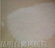 综ϵԭʲô