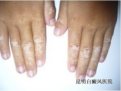 <a href=http://www.kmpifu.cn/bdfbk/ target=_blank class=infotextkey>ʲô</a>ɵ