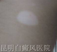 紫Ⱦ