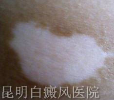 粻ȥƵΣ