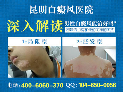 缲ʲôֱ淽