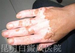 糣ĳ֢״