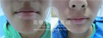 沿Σ