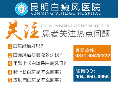 昆明看白癜风哪家医院看的好