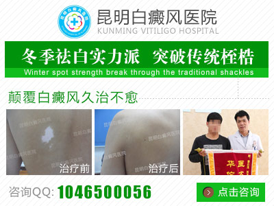白癜风患者洗澡时要不要防止搓伤