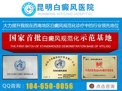多发型白癜风有哪些症状表现