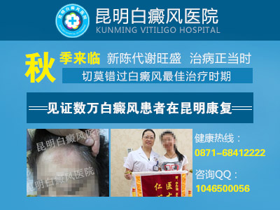 白癜风的特征有哪些