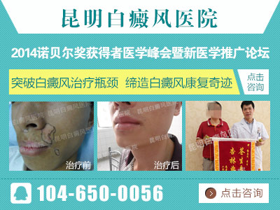 治疗青少年白癜风有哪些有效的方法