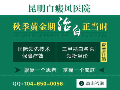 白癜风潜伏期有多久