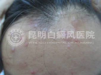 19沿װ